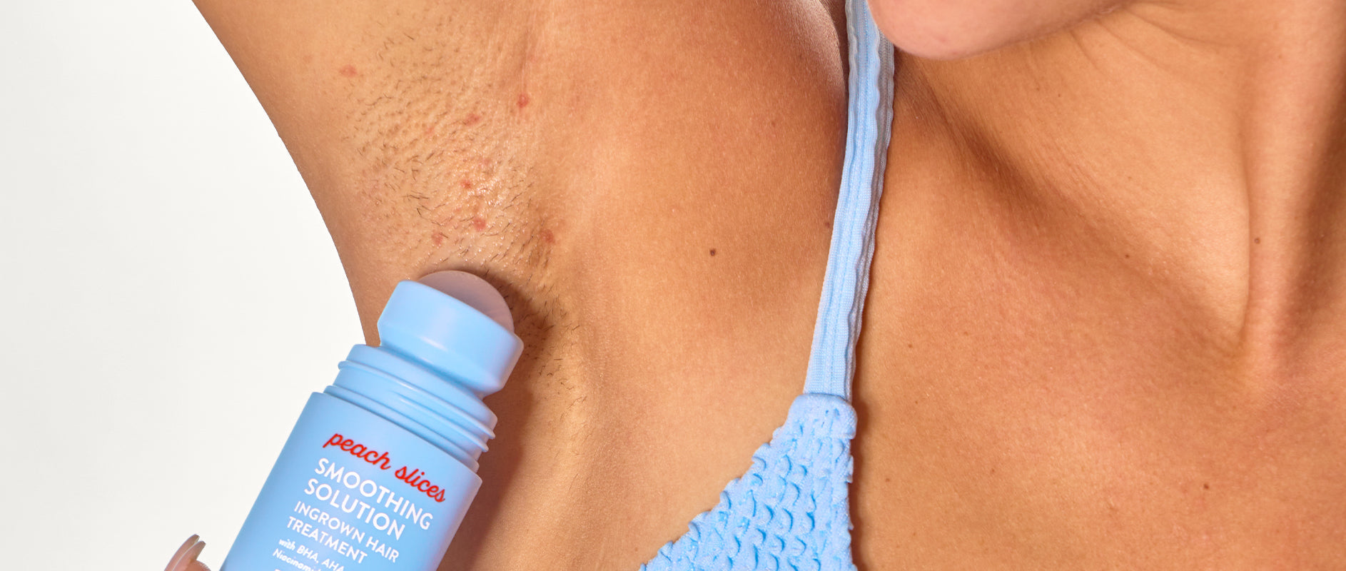 Peach & Lily Skin Concern - Ingrown Hairs